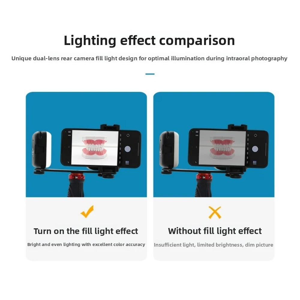 Dental Photography Light, Blue - Lighting Gallery 리뷰 및 가격